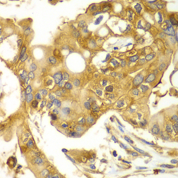 Anti-Calpain small subunit 1 Rabbit pAb