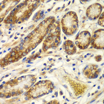 Anti-Calpain small subunit 1 Rabbit pAb