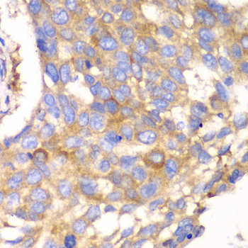 Anti-Calpain small subunit 1 Rabbit pAb