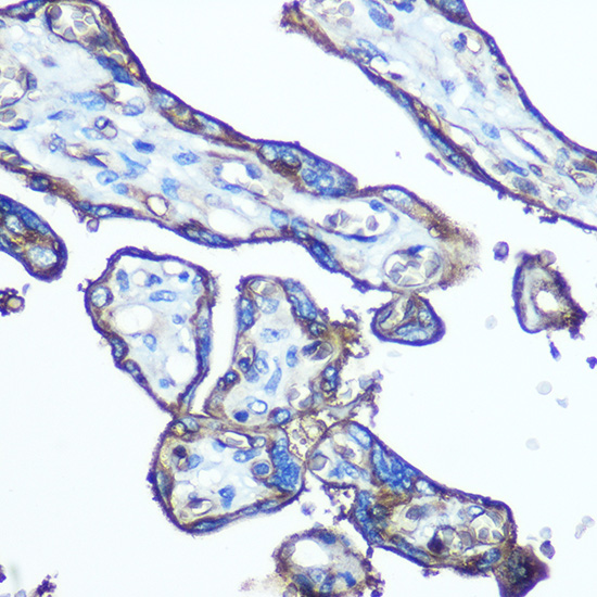 Anti-GLUT1/SLC2A1 Rabbit pAb
