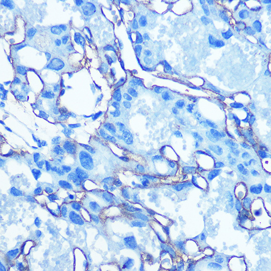 Anti-GLUT1/SLC2A1 Rabbit pAb