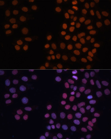 Anti-HMGN1 Rabbit pAb