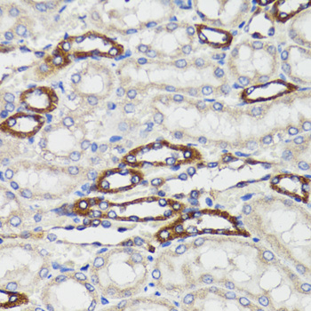 Anti-BCAP29 Rabbit pAb
