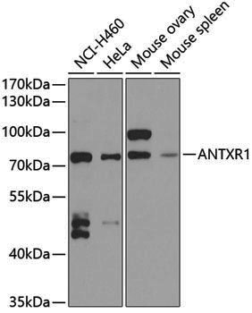 Anti-ANTXR1 Rabbit pAb