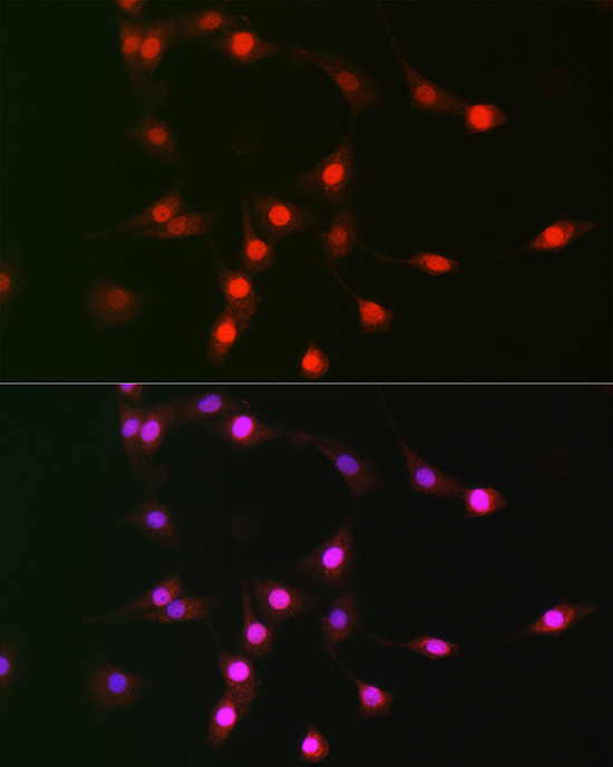 Anti-CDKN2D Rabbit pAb