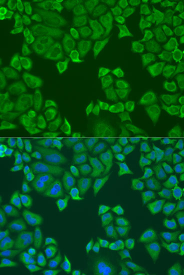 Anti-PABPC4 Rabbit pAb
