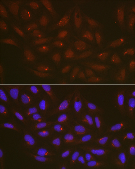 Anti-ATG14 Rabbit pAb
