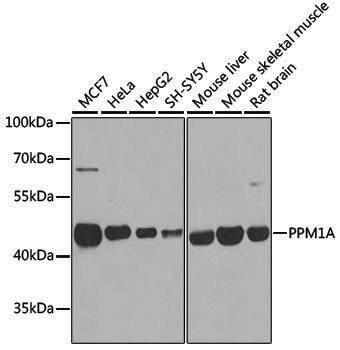Anti-PPM1A Rabbit pAb