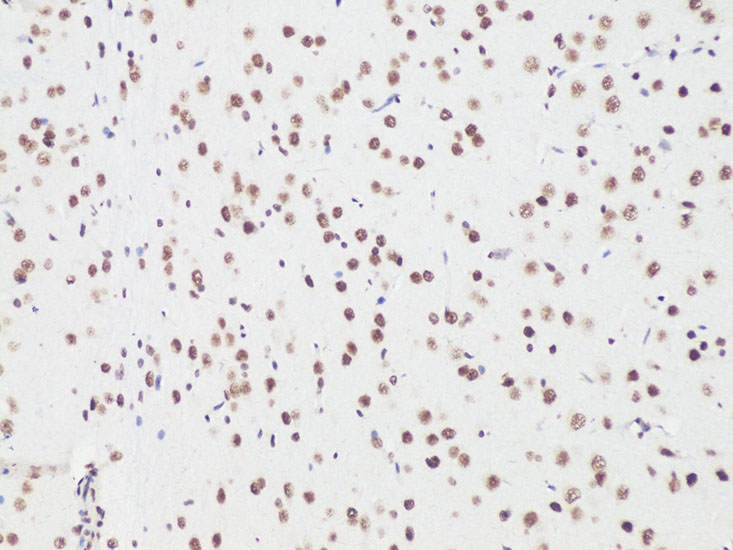 Anti-Bcl9 Rabbit pAb
