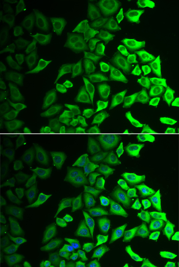 Anti-IL18BP Rabbit pAb