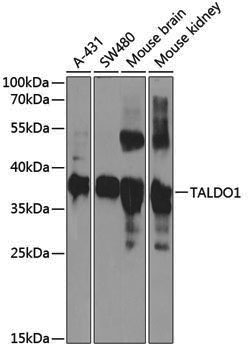 Anti-TALDO1 Rabbit pAb
