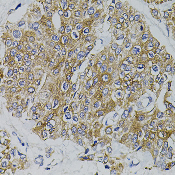Anti-ARHGEF11 Rabbit pAb