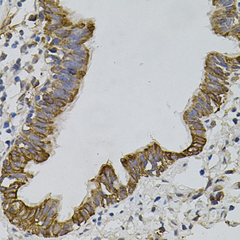 Anti-ARHGEF11 Rabbit pAb