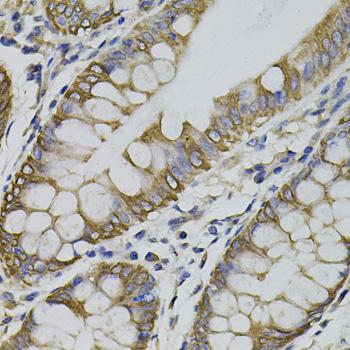 Anti-ARHGEF11 Rabbit pAb