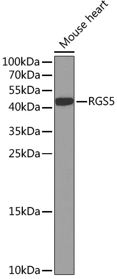 Anti-RGS5 Rabbit pAb