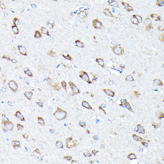 Anti-ETFA Rabbit pAb