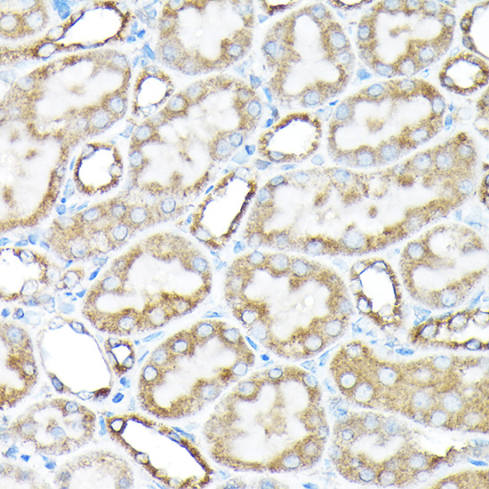 Anti-ETFA Rabbit pAb