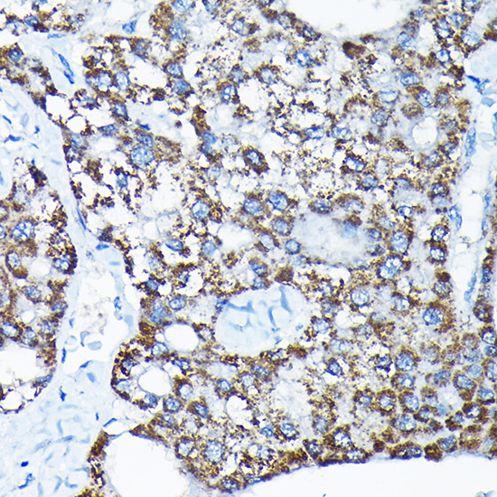 Anti-ETFA Rabbit pAb