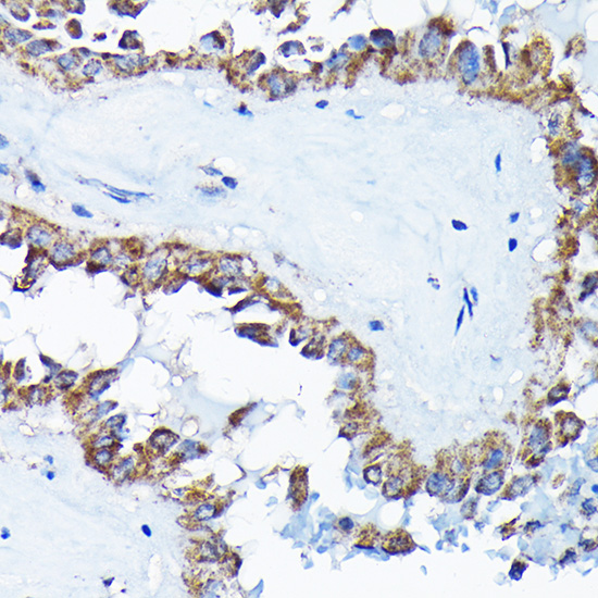 Anti-ETFA Rabbit pAb