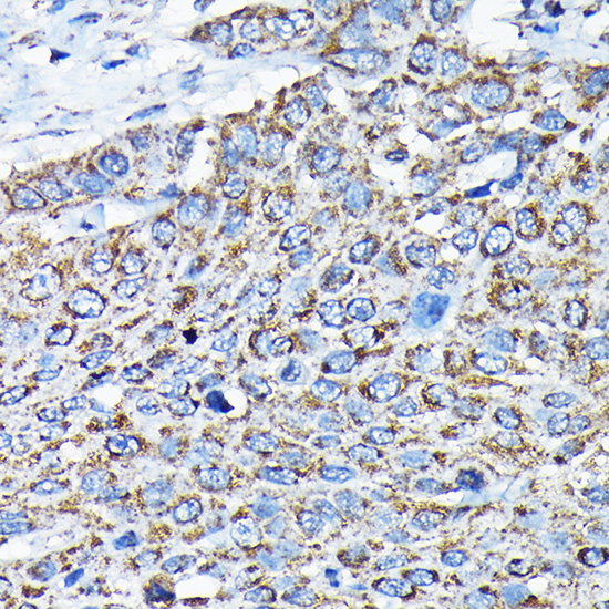 Anti-ETFA Rabbit pAb