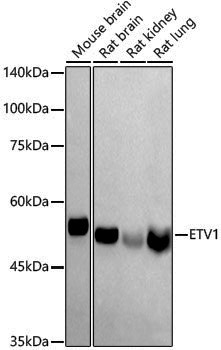 Anti-ETV1 Rabbit pAb