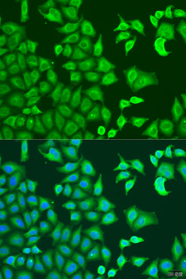 Anti-CAPZB Rabbit pAb