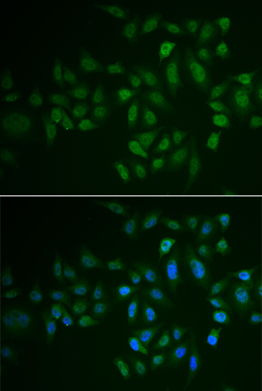 Anti-MYLK3 Rabbit pAb