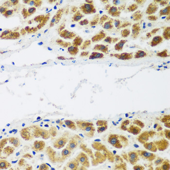 Anti-NAA60 Rabbit pAb