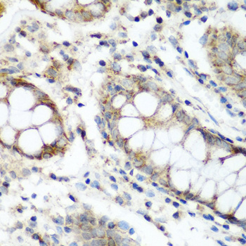 Anti-NAA60 Rabbit pAb