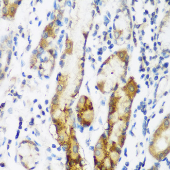 Anti-NAA60 Rabbit pAb
