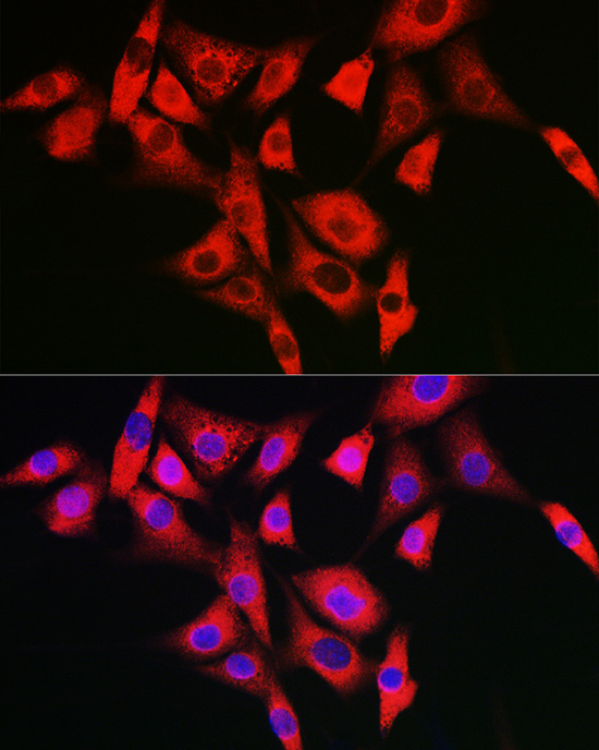 Anti-NLRP2 Rabbit pAb