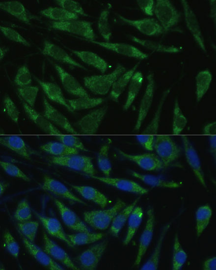 Anti-PITRM1 Rabbit pAb