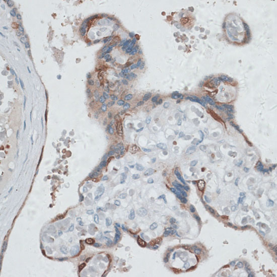 Anti-HDAC7 Rabbit pAb