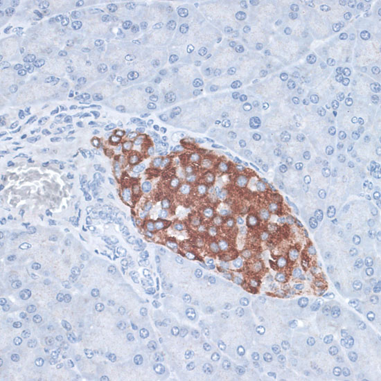 Anti-HDAC7 Rabbit pAb