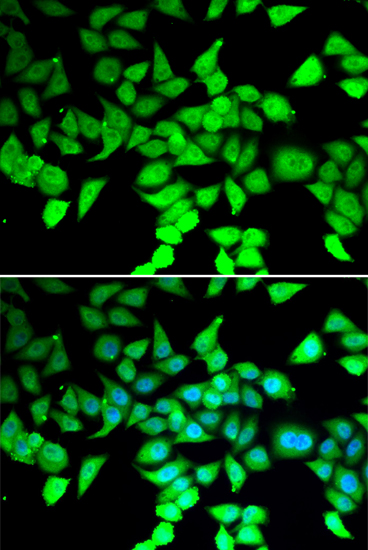 Anti-HDAC7 Rabbit pAb
