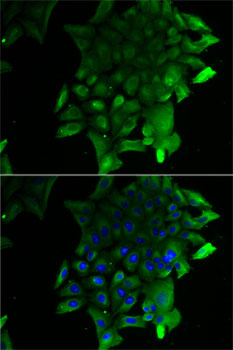 Anti-SEPSECS Rabbit pAb