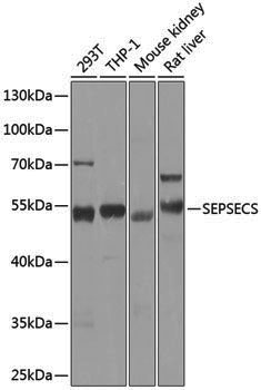 Anti-SEPSECS Rabbit pAb