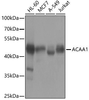 Anti-ACAA1 Rabbit pAb