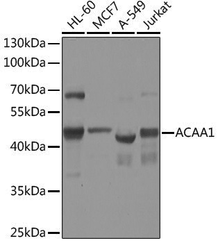 Anti-ACAA1 Rabbit pAb