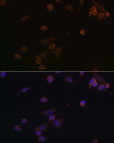 Anti-NDUFA2 Rabbit pAb
