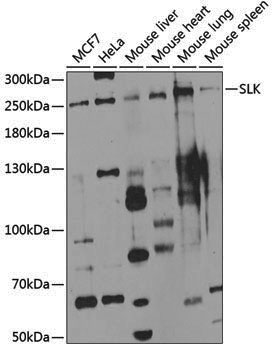 Anti-SLK Rabbit pAb