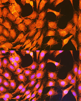 Anti-PHKG2 Rabbit pAb