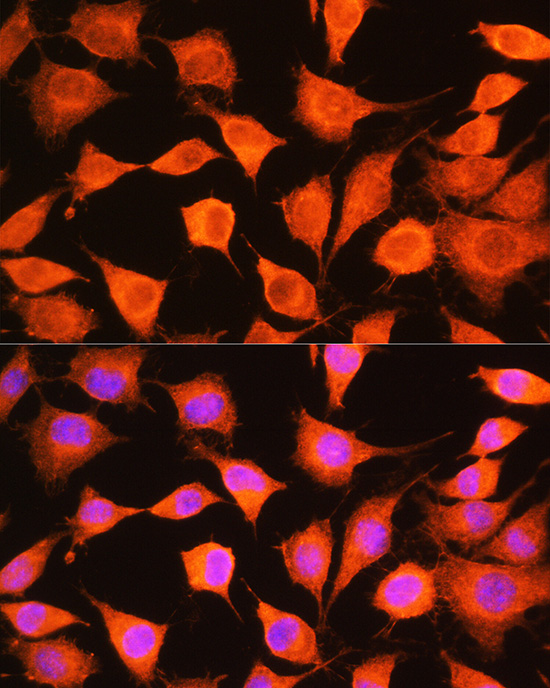 Anti-PHKG2 Rabbit pAb