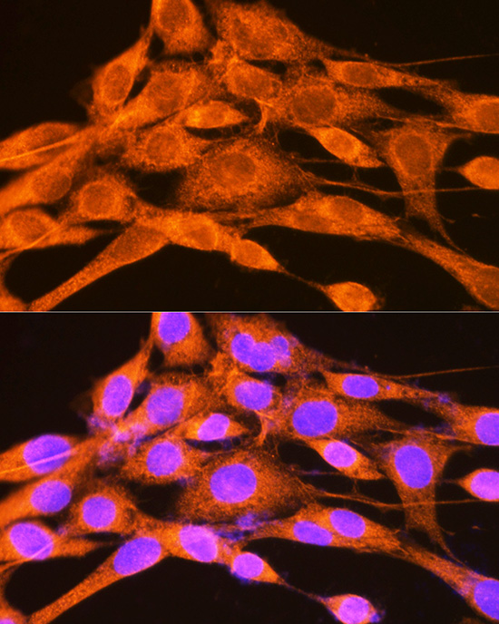 Anti-PHKG2 Rabbit pAb