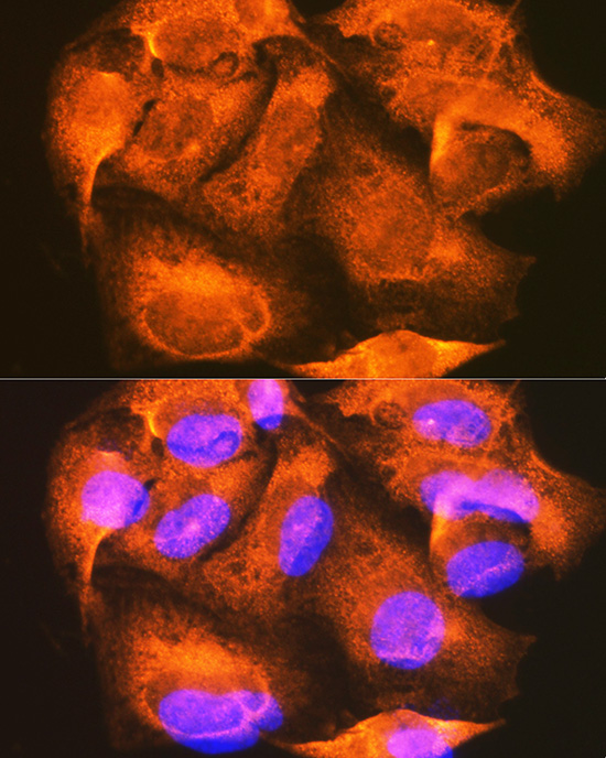 Anti-PHKG2 Rabbit pAb