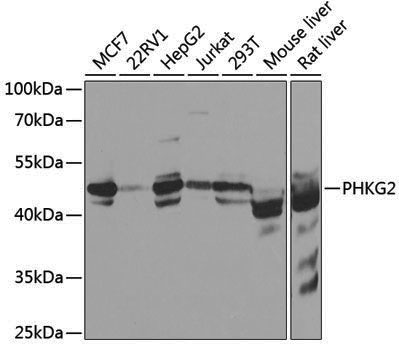 Anti-PHKG2 Rabbit pAb