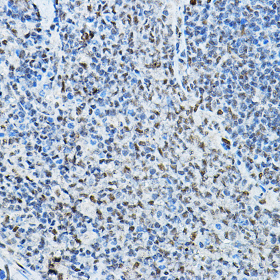 Anti-NCOR2 Rabbit pAb