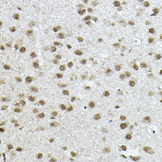 Anti-NCOR2 Rabbit pAb