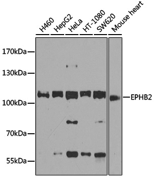 Anti-EPHB2 Rabbit pAb