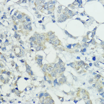 Anti-SOCS5 Rabbit pAb